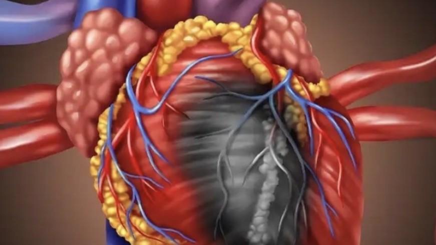  《心梗年轻化：压力如何成为心脏的"隐形杀手"》 健康养生